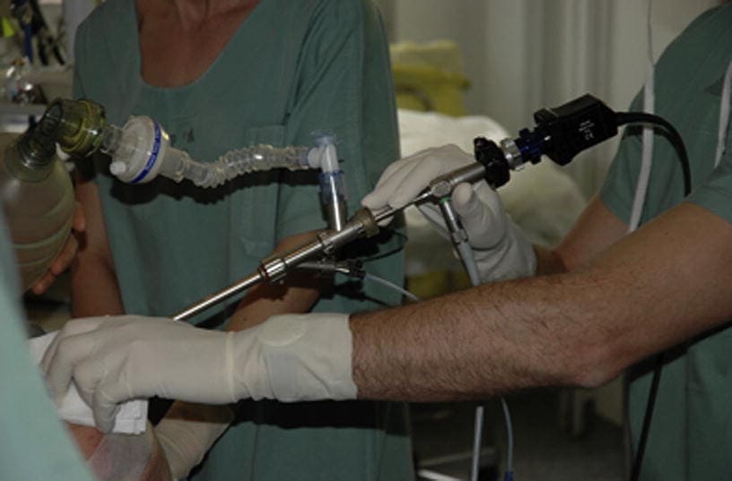 endobronchial-ultrasound-treatmentn